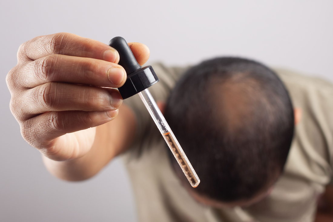 O que é Minoxidil?